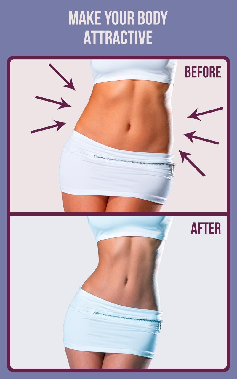 Rhinoplasty