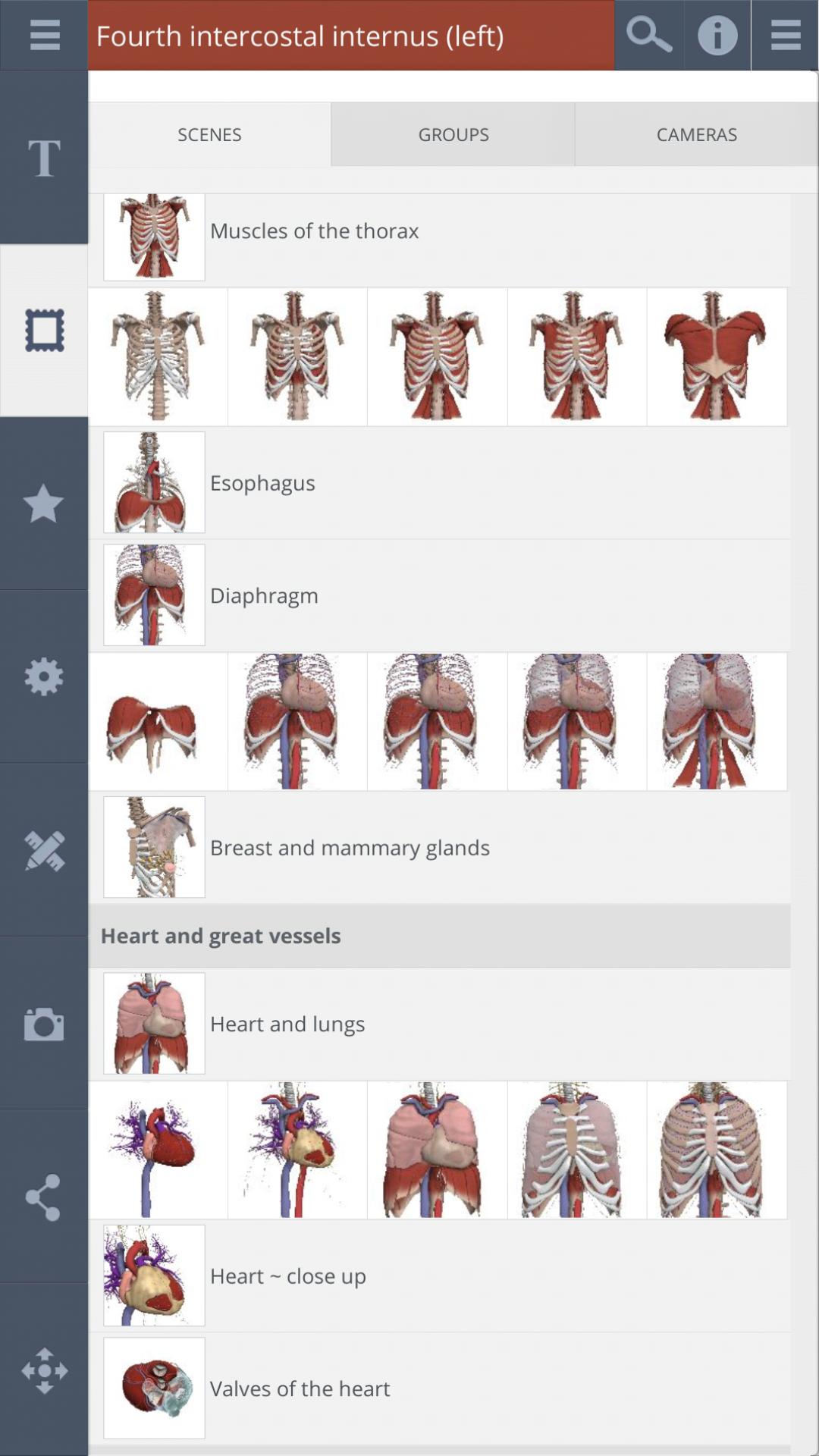 Thorax: 3D RT - Sub